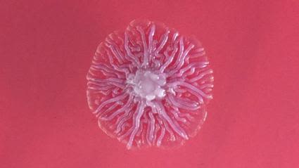 Burkholderia pseudomallei colonies in a petri dish