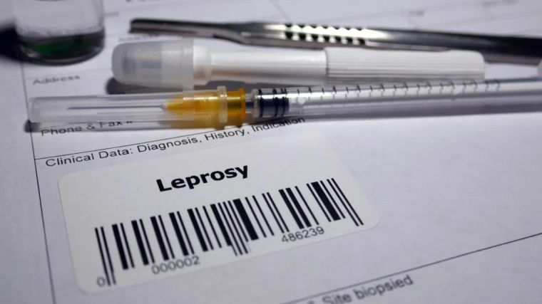 Needle with a sample tag 'Leprosy'