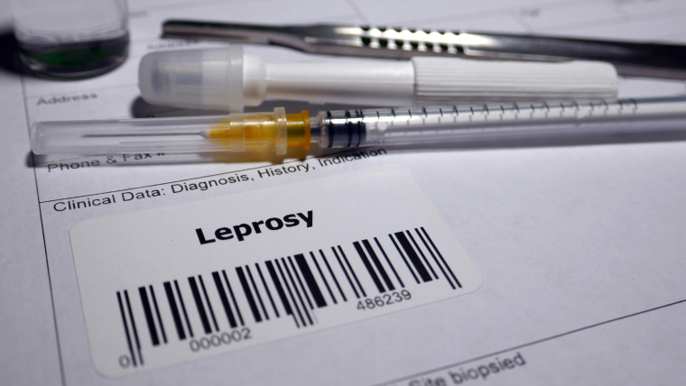Needle on a card with a barcode and the text Leprosy