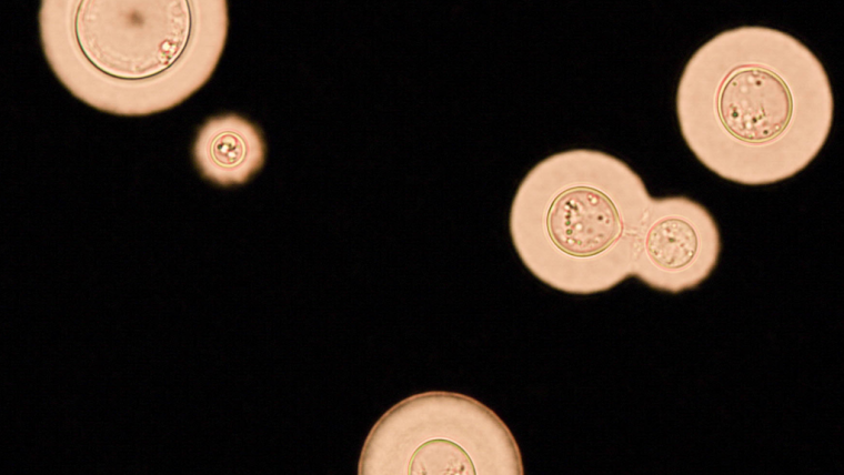 Typical spherical to oval cells of Cryptococcus neoformans, with extensive capsules and a budding daughter cell
