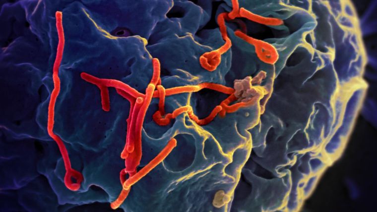 Ebola virus close-up