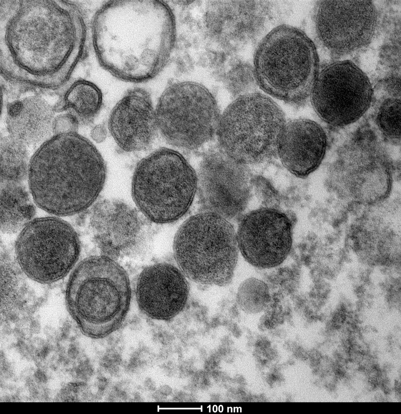 Image of P. falciparum extracellular vesicles captured with Transmission electron microscope