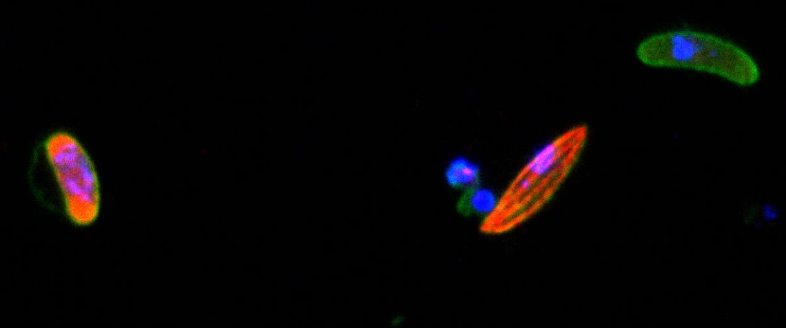 IFA of P. falciparum mature stage V male (left; green and red) and female (top right; green) gametocytes. A stage IV gametocyte can be observed in the centre of the image.